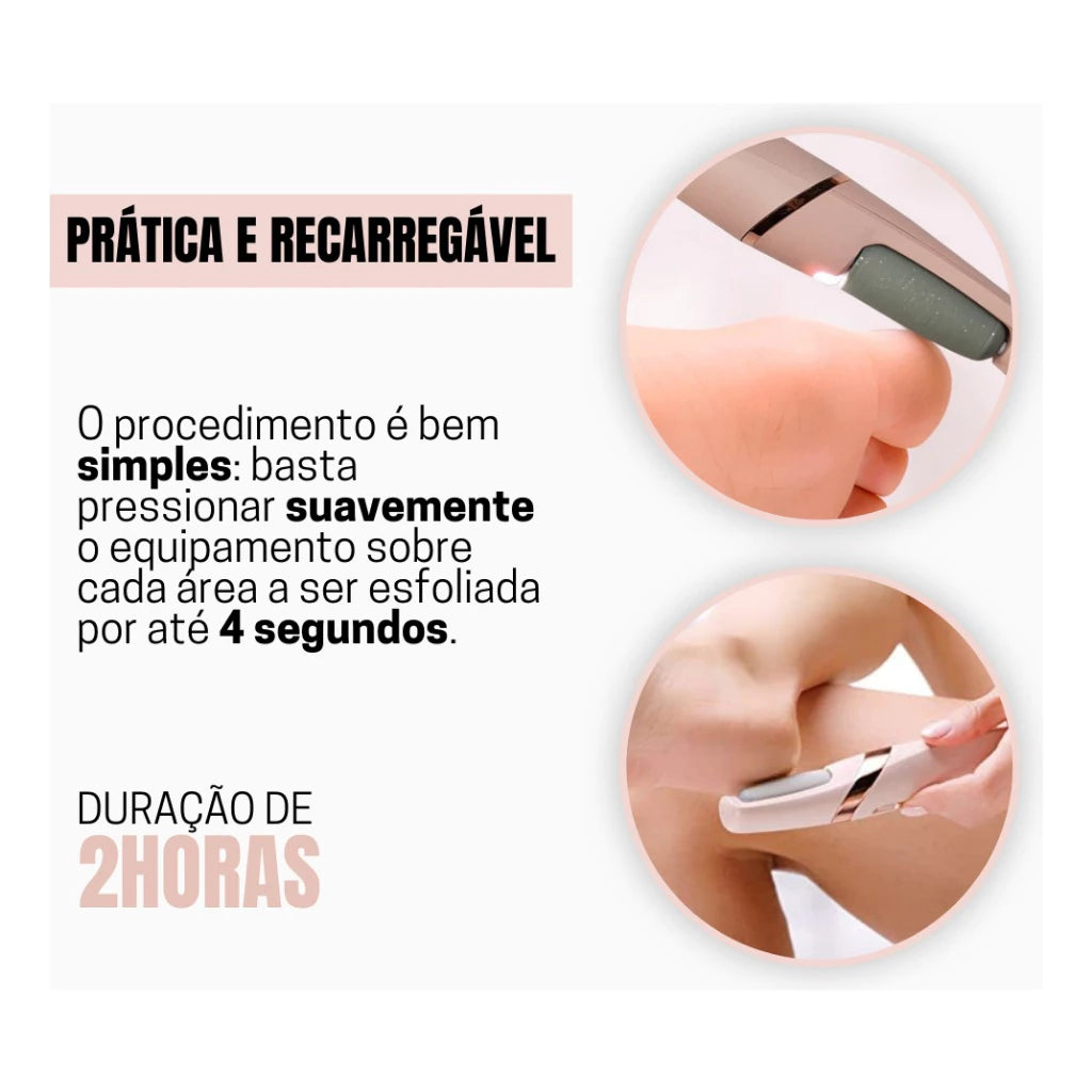 Lixador De Pé Elétrico Lixa Elimina Calo Portátil Usb Pilha