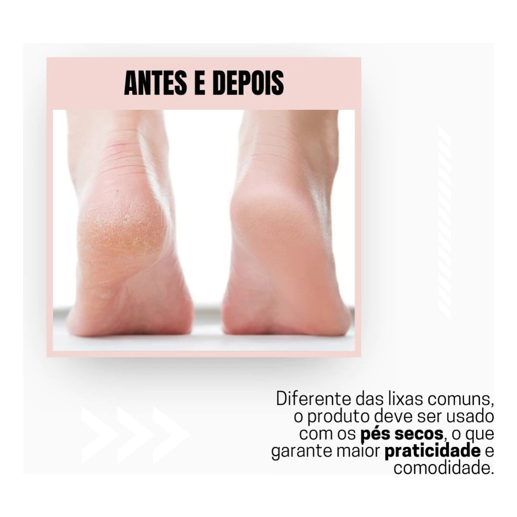 Lixador De Pé Elétrico Lixa Elimina Calo Portátil Usb Pilha